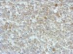 PPME1 Antibody in Immunohistochemistry (Paraffin) (IHC (P))