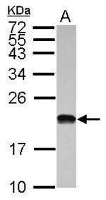 POLR1D Antibody in Western Blot (WB)