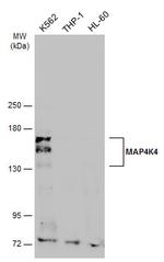 HGK Antibody in Western Blot (WB)