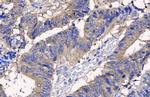 Protein APC Antibody in Immunohistochemistry (Paraffin) (IHC (P))