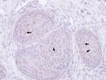 Presenilin 1 Antibody in Immunohistochemistry (Paraffin) (IHC (P))