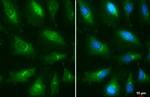 Presenilin 1 Antibody in Immunocytochemistry (ICC/IF)