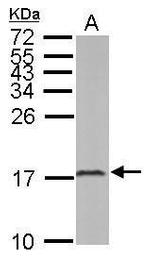 LC3B Antibody in Western Blot (WB)