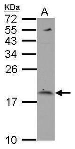 LC3B Antibody in Western Blot (WB)