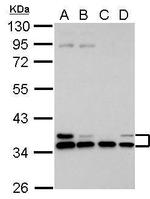 HLA-E Antibody in Western Blot (WB)