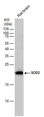 SOD2 Antibody in Western Blot (WB)