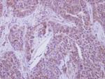 YBX2 Antibody in Immunohistochemistry (Paraffin) (IHC (P))