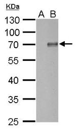 PIASy Antibody in Western Blot (WB)