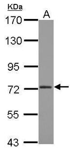 CPSF3 Antibody in Western Blot (WB)