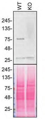 VPS35 Antibody in Western Blot (WB)