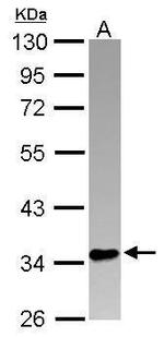 PINX1 Antibody in Western Blot (WB)