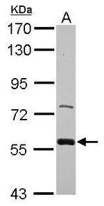 ZWILCH Antibody in Western Blot (WB)