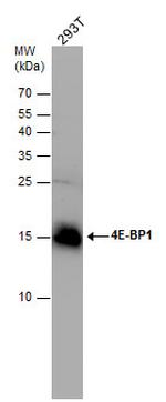 4EBP1 Antibody in Western Blot (WB)