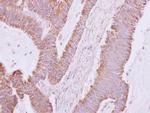 DDAH2 Antibody in Immunohistochemistry (Paraffin) (IHC (P))