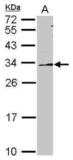 DDAH2 Antibody in Western Blot (WB)