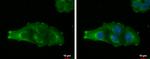 MAGEA4 Antibody in Immunocytochemistry (ICC/IF)