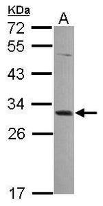 MAGEA4 Antibody in Western Blot (WB)