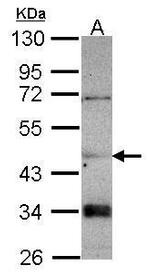 CNDP2 Antibody in Western Blot (WB)