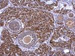 RAB33B Antibody in Immunohistochemistry (Paraffin) (IHC (P))