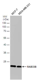 RAB33B Antibody in Western Blot (WB)