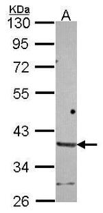 HAPLN2 Antibody in Western Blot (WB)