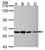 NXF3 Antibody in Western Blot (WB)