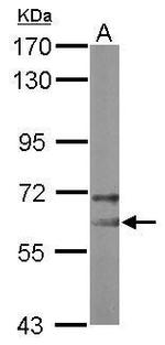 NOP58 Antibody in Western Blot (WB)