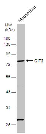 GIT2 Antibody in Western Blot (WB)