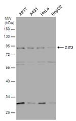 GIT2 Antibody in Western Blot (WB)