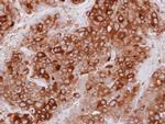 UBASH3A Antibody in Immunohistochemistry (Paraffin) (IHC (P))