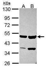 SMYD2 Antibody in Western Blot (WB)