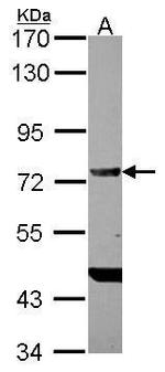 DDX4 Antibody in Western Blot (WB)