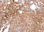 MKS1 Antibody in Immunohistochemistry (Paraffin) (IHC (P))