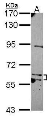 MKS1 Antibody in Western Blot (WB)