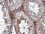 PPP2R2D Antibody in Immunohistochemistry (Paraffin) (IHC (P))