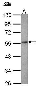 PPP2R2D Antibody in Western Blot (WB)