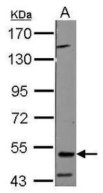 RNF23 Antibody in Western Blot (WB)