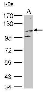 KIF17 Antibody in Western Blot (WB)