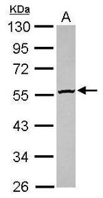 GBA3 Antibody in Western Blot (WB)