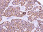 CYP4F11 Antibody in Immunohistochemistry (Paraffin) (IHC (P))