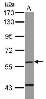 CYP4F11 Antibody in Western Blot (WB)