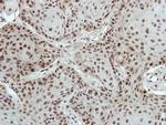 PTBP2 Antibody in Immunohistochemistry (Paraffin) (IHC (P))