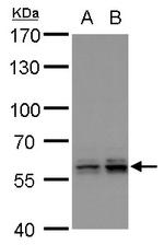 PTBP2 Antibody in Western Blot (WB)