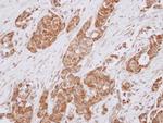 ALS2CR1 Antibody in Immunohistochemistry (Paraffin) (IHC (P))