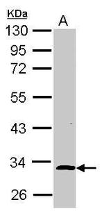 ALS2CR1 Antibody in Western Blot (WB)