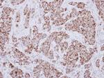 MCCC2 Antibody in Immunohistochemistry (Paraffin) (IHC (P))