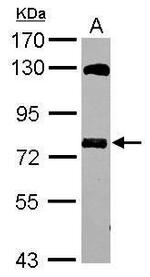 MTMR14 Antibody in Western Blot (WB)