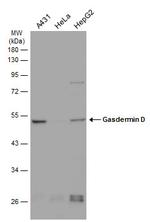 GSDMD Antibody in Western Blot (WB)