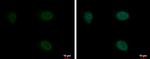 PYGO2 Antibody in Immunocytochemistry (ICC/IF)