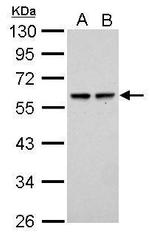 SESN2 Antibody in Western Blot (WB)